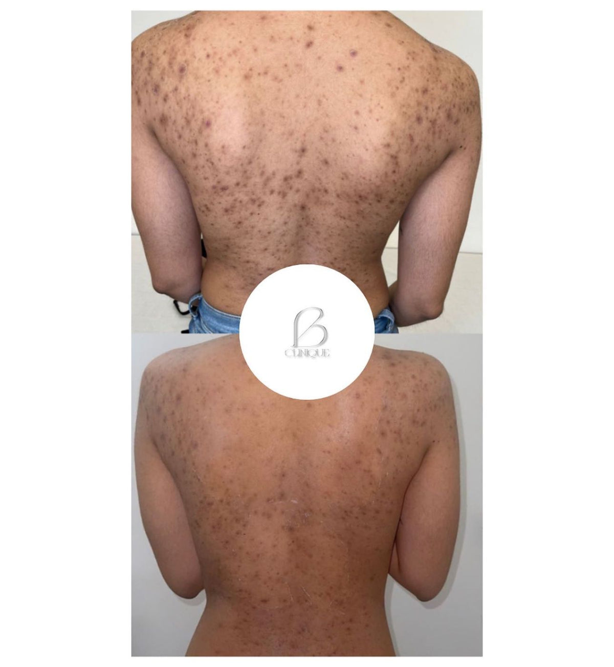 Peeling aux algues grandes zones (Dos, jambes)