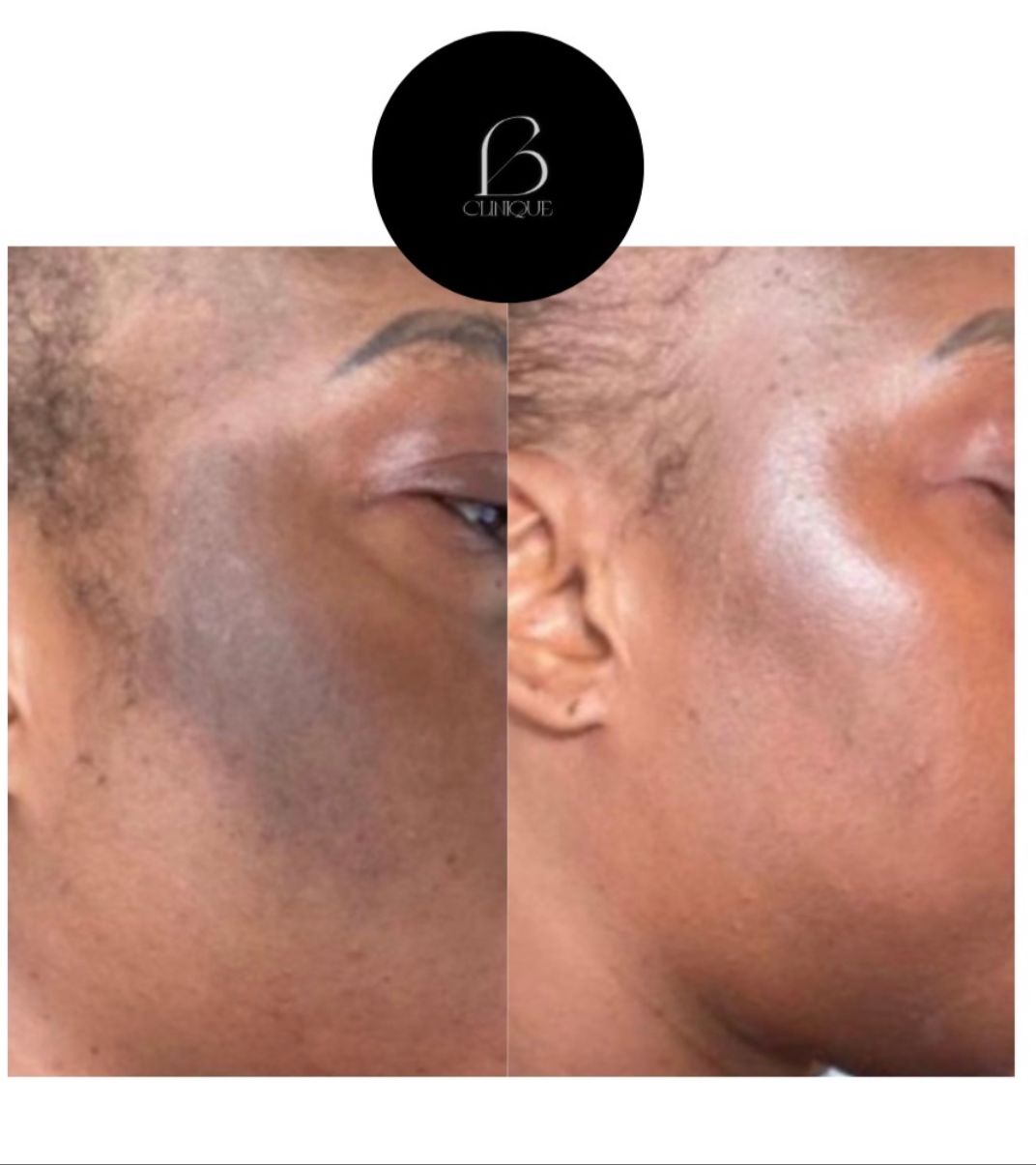 Peeling aux algues petites zones (Visage aisselles genoux) mains